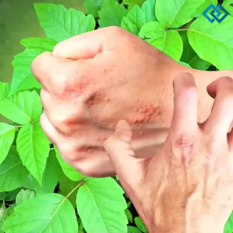 Poison Ivy Captions For Instagram